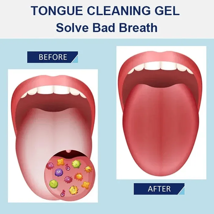 Tongue Cleaning Gel Set